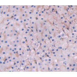 ATP Binding Cassette Transporter D1 (ABCD1) Antibody