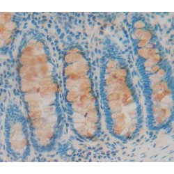 ATP Binding Cassette Transporter E1 (ABCE1) Antibody