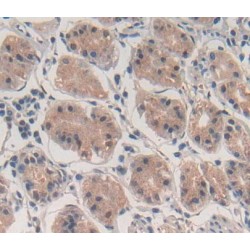 ATP Binding Cassette Transporter F1 (ABCF1) Antibody