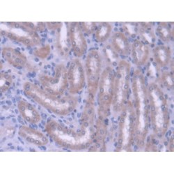 ATP Binding Cassette Subfamily G Member 8 (ABCG8) Antibody