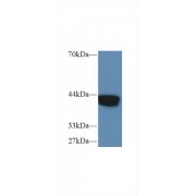 Western blot analysis of Human MCF7 cell lysate, using Human IVD Antibody (1 µg/ml) and HRP-conjugated Goat Anti-Rabbit antibody (<a href="https://www.abbexa.com/index.php?route=product/search&amp;search=abx400043" target="_blank">abx400043</a>, 0.2 µg/ml).