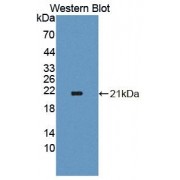 Western blot analysis of the recombinant protein.