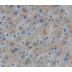 Peroxisomal D3, D2-Enoyl Coenzyme A Isomerase (PECI) Antibody