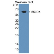 Western blot analysis of the recombinant protein.