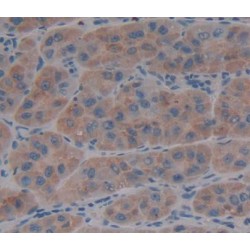 ADAM Metallopeptidase With Thrombospondin Type 1 Motif 13 / vWFCP (ADAMTS13) Antibody