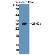 Western blot analysis of the recombinant protein.