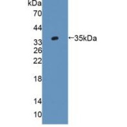 Alanine Glyoxylate Aminotransferase 2 (AGXT2) Antibody