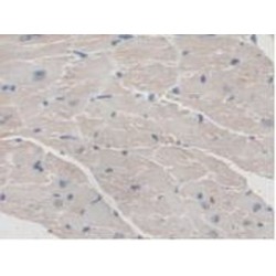 Aspartylglucosaminidase (AGA) Antibody