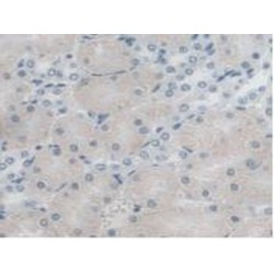 Aspartylglucosaminidase (AGA) Antibody