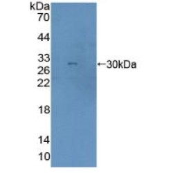 Aspartylglucosaminidase (AGA) Antibody