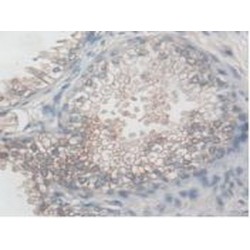 Aspartylglucosaminidase (AGA) Antibody