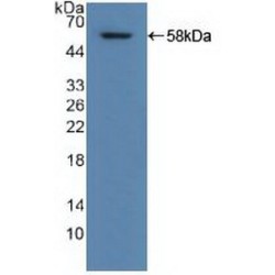 Retinal Dehydrogenase 1 (ALDH1A1) Antibody