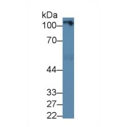 Western blot analysis of Human Serum, using Human AMPH Antibody (1 µg/ml) and HRP-conjugated Goat Anti-Rabbit antibody (<a href="https://www.abbexa.com/index.php?route=product/search&amp;search=abx400043" target="_blank">abx400043</a>, 0.2 µg/ml).