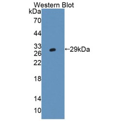 Amphiphysin (AMPH) Antibody