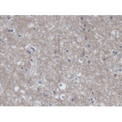 Amphiphysin (AMPH) Antibody