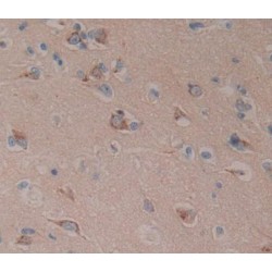 Amphiphysin (AMPH) Antibody