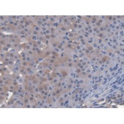 Cytosolic Ovarian Carcinoma Antigen 1 (COVA1) Antibody