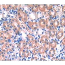 Cytosolic Ovarian Carcinoma Antigen 1 (COVA1) Antibody