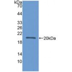 Apolipoprotein L2 (APOL2) Antibody