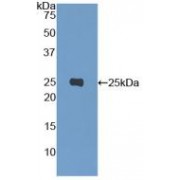 Western blot analysis of recombinant STAT3.