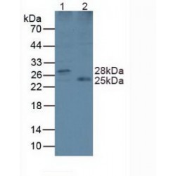 Lysophospholipase II (LYPLA2) Antibody