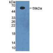 Western blot analysis of recombinant Human bACE1.