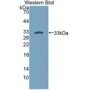 Western blot analysis of the recombinant protein.