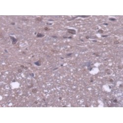 Mitochondrial Tumor Suppressor 1 (MTUS1) Antibody