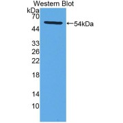 Western blot analysis of the recombinant protein.