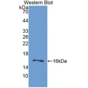 Western blot analysis of recombinant Human GRPR Protein.