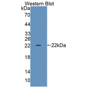 Western blot analysis of the recombinant protein.