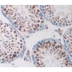 Transcriptional Regulating Factor 1 (TRERF1) Antibody