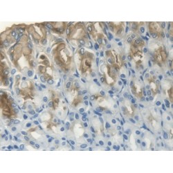 Trefoil Factor 1 (TFF1) Antibody