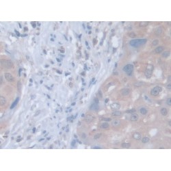 Leucine Zipper, Down Regulated In Cancer 1 (LDOC1) Antibody