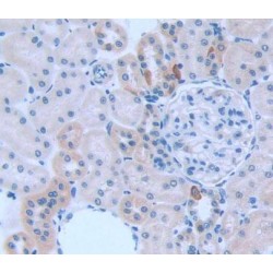 Kininogen 1 (KNG1) Antibody