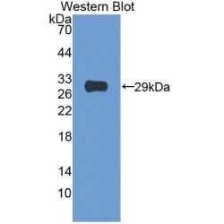 Neuronal Apoptosis Inhibitory Protein (NAIP) Antibody