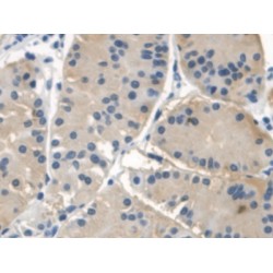 Neuronal Apoptosis Inhibitory Protein (NAIP) Antibody