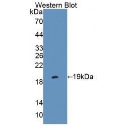 Endoplasmic Reticulum Protein 29 (ERP29) Antibody