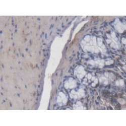 Calcitonin Receptor (CALCR) Antibody