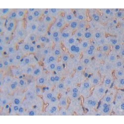 Calcitonin Receptor (CALCR) Antibody