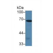 Western blot analysis of Mouse Spleen lysate, using Rat CALD Antibody (1 µg/ml) and HRP-conjugated Goat Anti-Rabbit antibody (<a href="https://www.abbexa.com/index.php?route=product/search&amp;search=abx400043" target="_blank">abx400043</a>, 0.2 µg/ml).