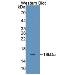 Caldesmon (CALD1) Antibody