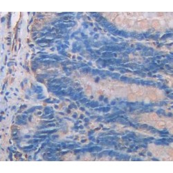 Caldesmon (CALD1) Antibody