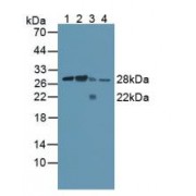 Western blot analysis of (1) Human Lung Tissue, (2) Human Blood Cells, (3) Human A431 Cells and (4) Mouse Spleen Tissue.