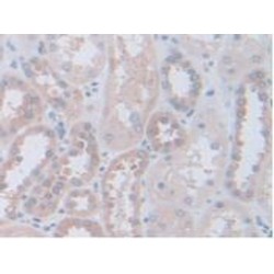 Calpain, Small Subunit 1 (CAPNS1) Antibody