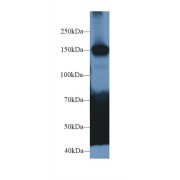 Western blot analysis of Mouse Cerebrum lysate, using Human CADPS Antibody (2 µg/ml) and HRP-conjugated Goat Anti-Rabbit antibody (<a href="https://www.abbexa.com/index.php?route=product/search&amp;search=abx400043" target="_blank">abx400043</a>, 0.2 µg/ml).
