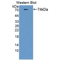 Cartilage Associated Protein (CRTAP) Antibody