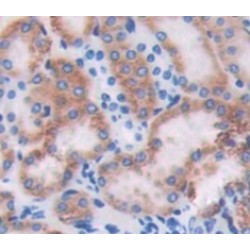 Cartilage Associated Protein (CRTAP) Antibody