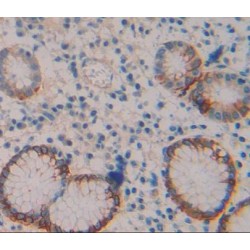 Transient Receptor Potential Cation Channel Subfamily V, Member 6 (TRPV6) Antibody