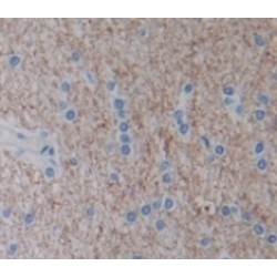 Nephroblastoma Overexpressed Gene (NOV) Antibody